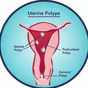 国内做试管婴儿价格多少,明细有哪些!